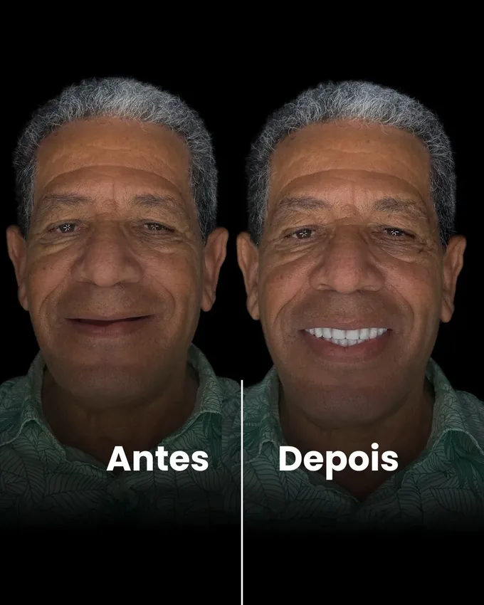 Antes e depois de tratamento odontológico em Cuiabá